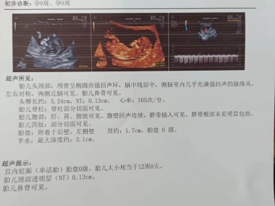1000台币是多少人民币？1000台币是多少人民币啊？(知乎）
