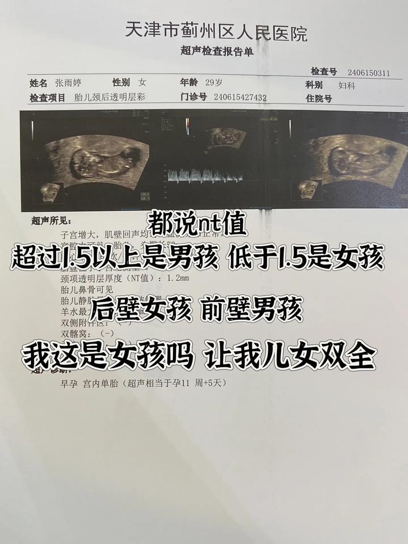 nt1500是多少人民币
